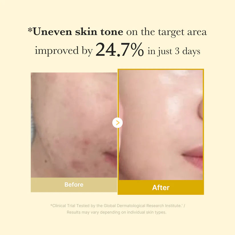 Kojic Turmeric Overnight Wrapping Mask